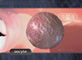 Oocyte