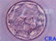 Early Blastocyst