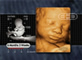 Rostro de feto de 27 semanas