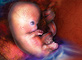 7� -Week Embryo