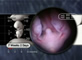 Lower Embryo 7 Weeks 2 Days