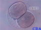 Embrión de dos células