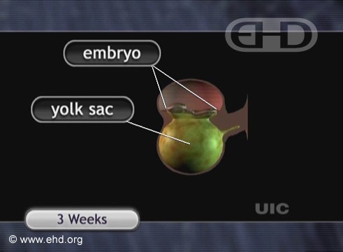 Embrión de 3 semanas [Haga clic para la siguiente imagen]