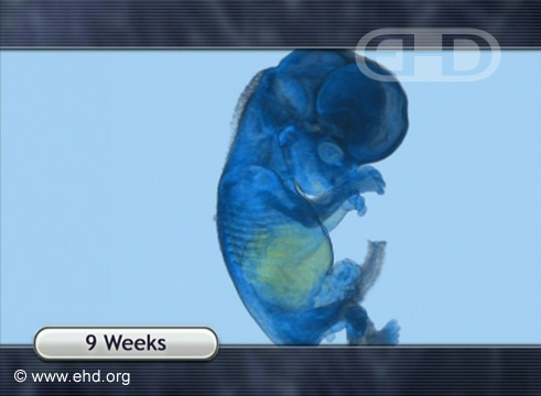9-Week Fetus, MRI Animation