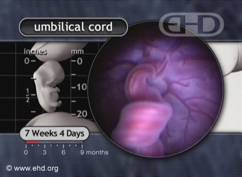 Primer plano del cordón umbilical [Haga clic para la siguiente imagen]