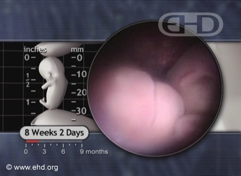 Nariz y boca, embarazo de 8 semanas [Haga clic para la siguiente imagen]
