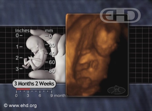 El feto de 3½ meses [Haga clic para la siguiente imagen]