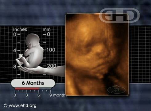 A Face Fetal de 6 Meses [Clique para a próxima imagem]