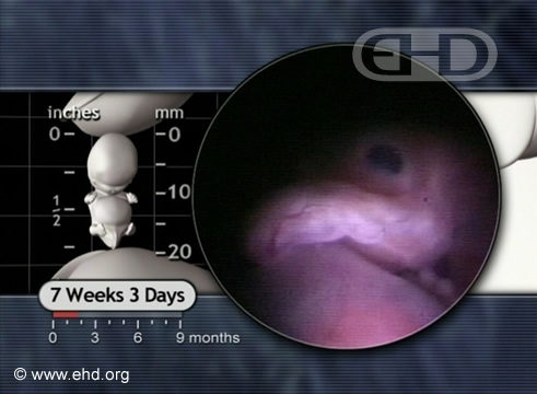 El rostro de 7½ semanas [Haga clic para la siguiente imagen]