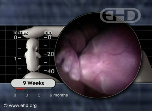 El feto de 9 semanas [Haga clic para la siguiente imagen]