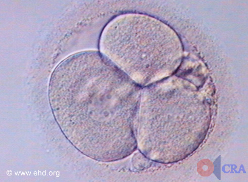 Embrión de tres células [Haga clic para la siguiente imagen]