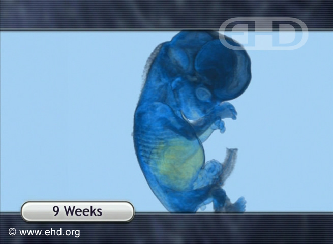 9-Week Fetus, MRI Animation [Click for next image]