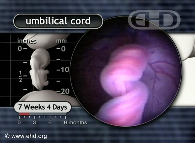 Close do Cordão Umbilical de 7½ Semanas [Clique para a próxima imagem]