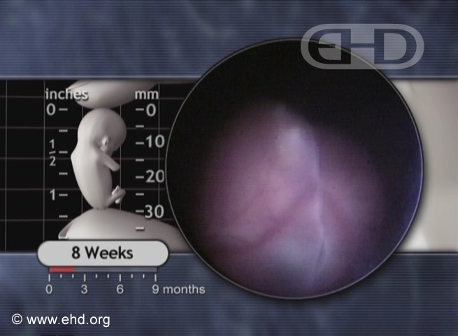 Ojo y nariz de embrión de ocho semanas [Haga clic para la siguiente imagen]