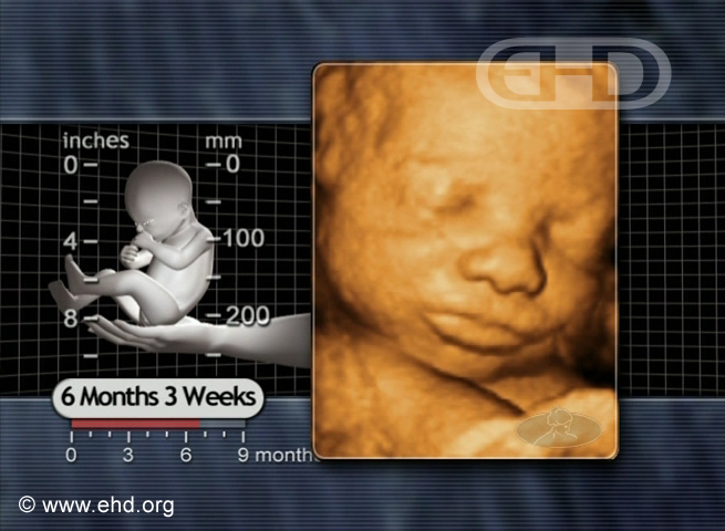 Rostro de feto de 27 semanas [Haga clic para la siguiente imagen]