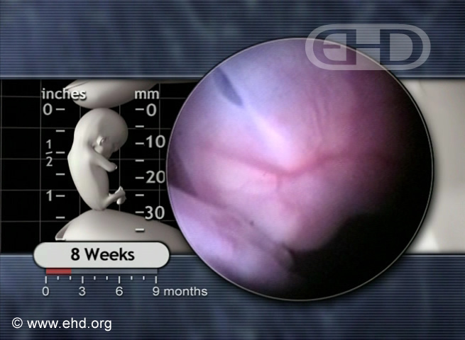 Rostro del embrión de 8 semanas [Haga clic para la siguiente imagen]