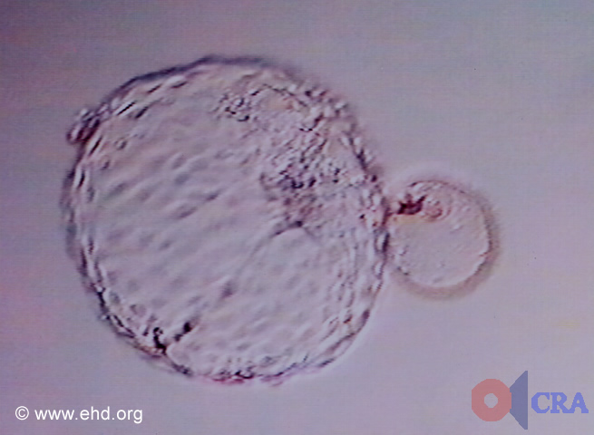 Hatched Blastocyst [Click for next image]