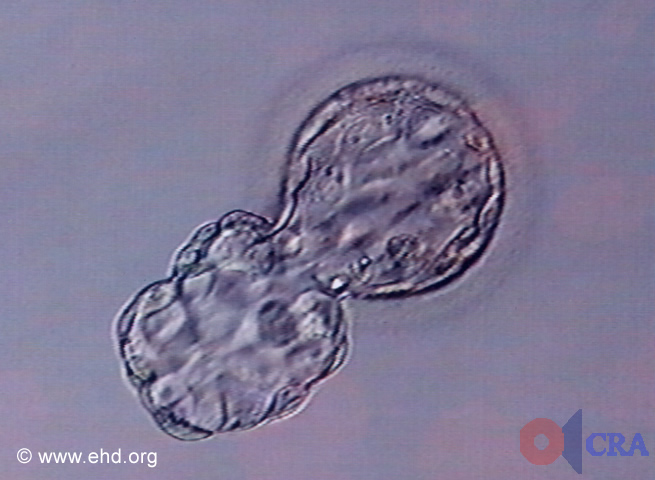 Hatching Blastocyst [Click for next image]