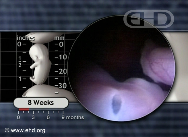 Ojo derecho y perfil facial [Haga clic para la siguiente imagen]