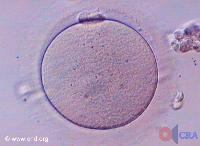 Secondary Oocyte