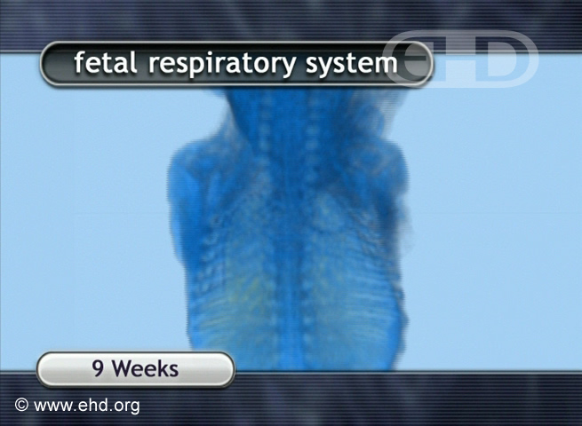 El feto de 9 semanas en una resonancia magnética [Haga clic para la siguiente imagen]