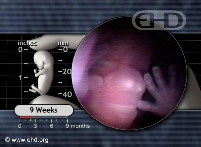 The Face at 9 Weeks [Click for next image]