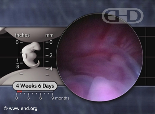 O Embrião Inferior [Clique para a próxima imagem]