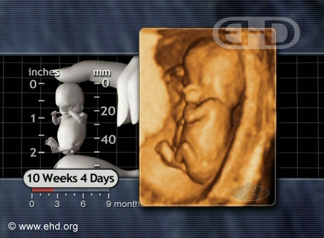 The Original Fetal Position [Click for next image]