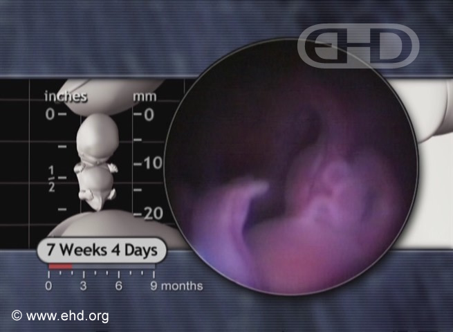 The Umbilical Cord at 7½ Weeks [Click for next image]