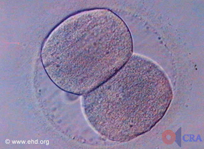 Two-Cell Embryo [Click for next image]