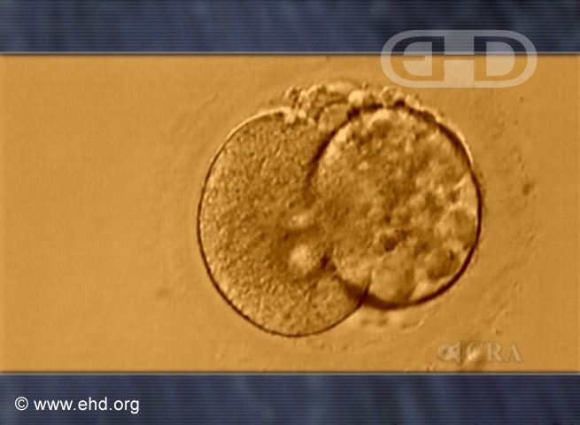 Two-Cell Human Embryo [Click for next image]