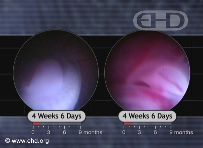 Upper and Lower Limb Buds [Click for next image]