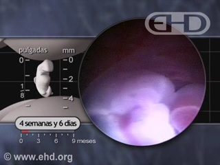 Reproducir película - Amniotic Fluid