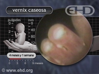 Reproducir película - Vernix caseosa