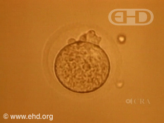 Reproducir película - Final del período embrionario
