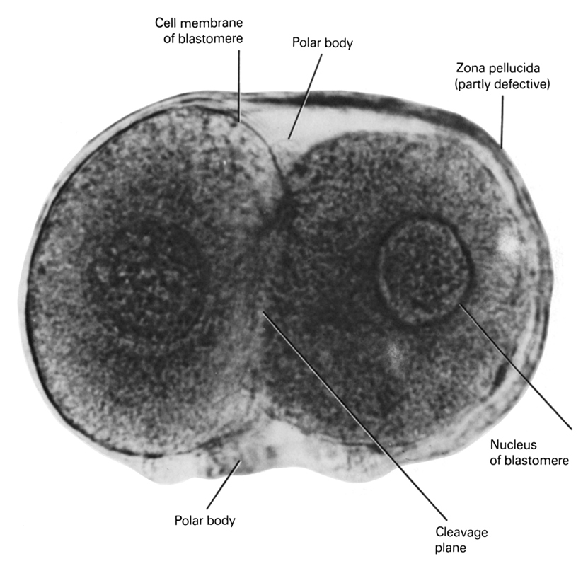 blastomere cell membrane, cleavage plane, nucleus of blastomere, polar body, zona pellucida