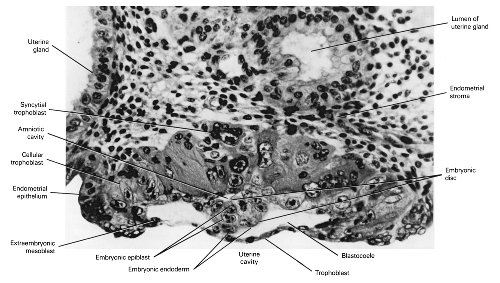 amniotic cavity, blastocystic cavity (blastocoele), cytotrophoblast, embryonic disc, embryonic endoderm, endometrial epithelium, endometrial stroma, epiblast, extra-embryonic mesoblast, lumen of uterine gland, syncytiotrophoblast, trophoblast, uterine cavity, uterine gland