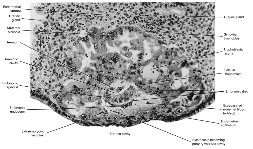amnion, amniotic cavity, blastocystic cavity (blastocoele), cytotrophoblast, embryonic disc, embryonic endoderm, endometrial epithelium, endometrial stroma, epiblast, extra-embryonic mesoblast, maternal blood cells, sinusoid, syncytiotrophoblast, trophoblast lacunae, umbilical vesicle cavity, uterine cavity, uterine gland