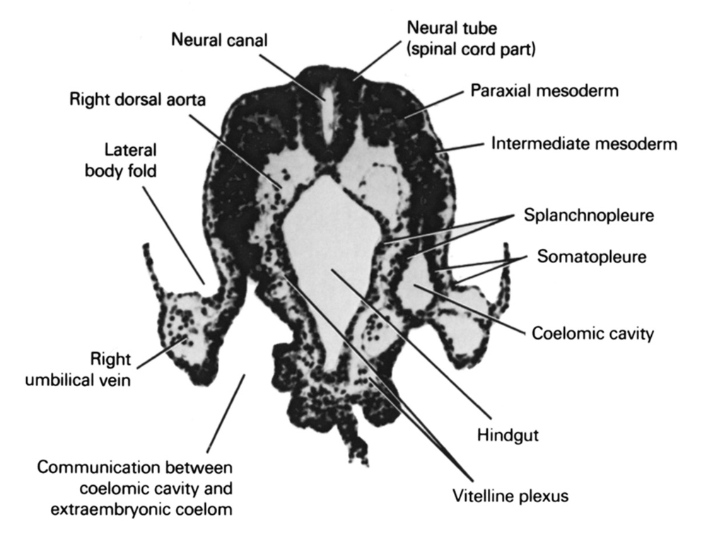 coelomic cavity, communication between coelomic cavity and extra-embryonic coelom, hindgut, intermediate mesoderm, lateral body fold, neural canal, neural tube (spinal cord part), paraxial mesoderm, right dorsal aorta, right umbilical vein, somatopleure, splanchnopleure, vitelline plexus