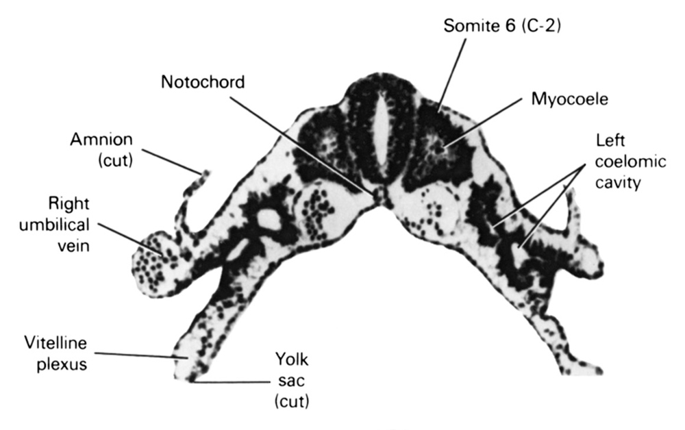 cut edge of amnion, cut edge of umbilical vesicle, left coelomic cavity, myocoele, notochord, right umbilical vein, somite 6 (C-2), vitelline plexus