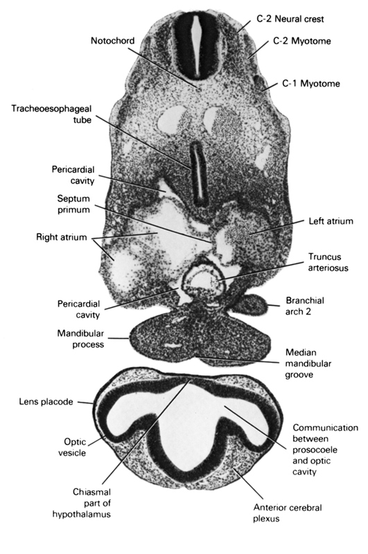C-1 myotome, C-2 myotome, C-2 neural crest, anterior cerebral plexus, chiasmal part of hypothalamus, communication between prosocoele and optic cavity, left atrium, lens placode, mandibular prominence of pharyngeal arch 1, median mandibular groove, notochord, optic vesicle, pericardial cavity, pharyngeal arch 2, right atrium, septum primum, tracheo-esophageal tube, truncus arteriosus
