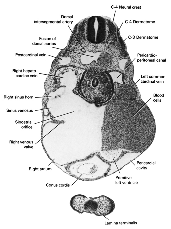 C-3 dermatome, C-4 dermatome, C-4 neural crest, blood cells, conus cordis, dorsal intersegmental artery, fusion of dorsal aortas, lamina terminalis, left common cardinal vein, pericardial cavity, pericardioperitoneal canal, postcardinal vein, primitive left ventricle, right atrium, right hepatocardiac vein, right horn of sinus venosus, right venous valve, sinu-atrial orifice, sinus venosus