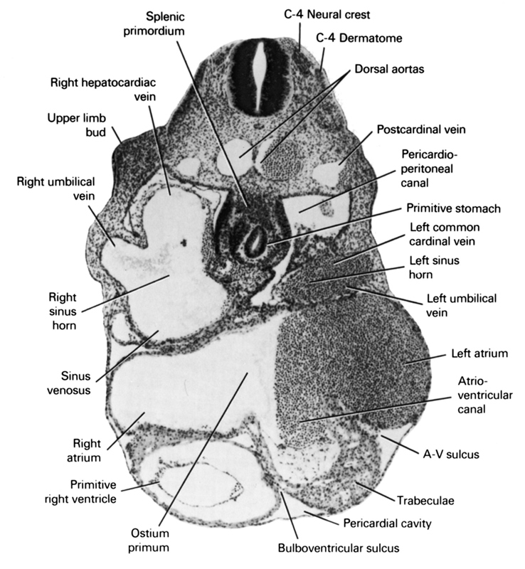 C-4 dermatome, C-4 neural crest, atrioventricular canal, atrioventricular sulcus, bulboventricular sulcus, dorsal aorta, left atrium, left common cardinal vein, left horn of sinus venosus, left umbilical vein, ostium primum, pericardial cavity, pericardioperitoneal canal, postcardinal vein, primitive right ventricle, primitive stomach, right atrium, right hepatocardiac vein, right horn of sinus venosus, right umbilical vein, sinus venosus, spleen primordium, trabeculae, upper limb bud