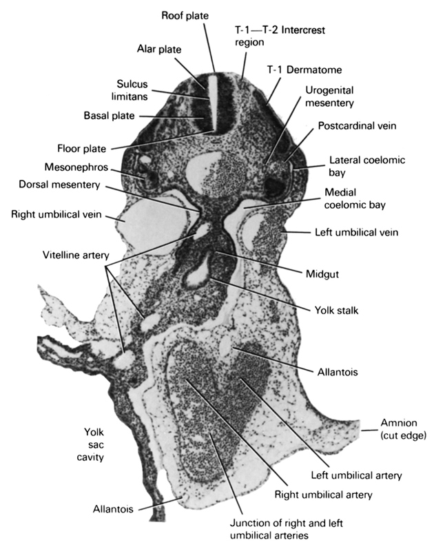 T-1 - T-2 intercrest region, T-1 dermatome, alar plate, allantois, amnion (cut edge), basal plate, dorsal mesentery, floor plate, junction of right and left umbilical arteries, lateral coelomic bay, left umbilical artery, left umbilical vein, medial coelomic bay, mesonephros, midgut, postcardinal vein, right umbilical artery, right umbilical vein, roof plate, sulcus limitans, urogenital mesentery, vitelline (omphalomesenteric) artery, yolk sac, yolk sac cavity