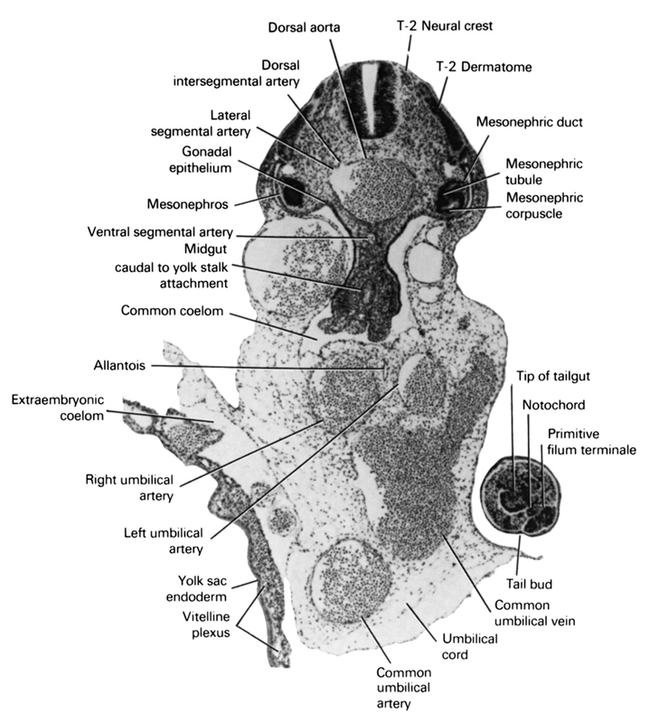 Midgut caudal to yolk sac attachment, T-2 dermatome, T-2 neural crest, allantois, common coelom, common umbilical artery, common umbilical vein, dorsal aorta, dorsal intersegmental artery, extraembryonic coelom, gonadal epithelium, lateral segmental artery, left umbilical artery, mesonephric corpuscle, mesonephric duct, mesonephric tubule, mesonephros, notochord, primitive filum terminale, right umbilical artery, tail bud, tip of tailgut, umbilical cord, ventral segmental artery, vitelline plexus, yolk sac endoderm