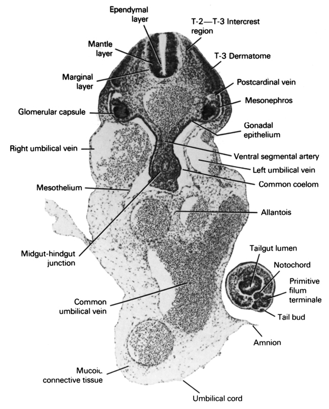 T-2 - T-3 intercrest region, T-3 dermatome, allantois, amnion, common coelom, common umbilical vein, ependymal layer, glomerular capsule, gonadal epithelium, left umbilical vein, mantle layer, marginal layer, mesonephros, mesothelium, midgut-hindgut junction, mucoid connective tissue, notochord, postcardinal vein, primitive filum terminale, right umbilical vein, tail bud, tailgut lumen, umbilical cord, ventral segmental artery