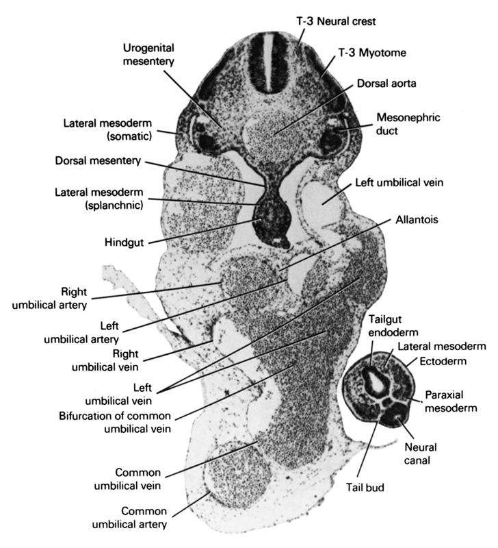 T-3 Myotome, T-3 neural crest, allantois, bifurcation of common umbilical vein, common umbilical artery, common umbilical vein, dorsal aorta, dorsal mesentery, ectoderm, hindgut, lateral mesoderm, lateral mesoderm (somatic), lateral mesoderm (splanchnic), left umbilical artery, left umbilical vein, mesonephric duct, neural canal, paraxial mesoderm, right umbilical artery, right umbilical vein, tail bud, tailgut endoderm, urogenital mesentery