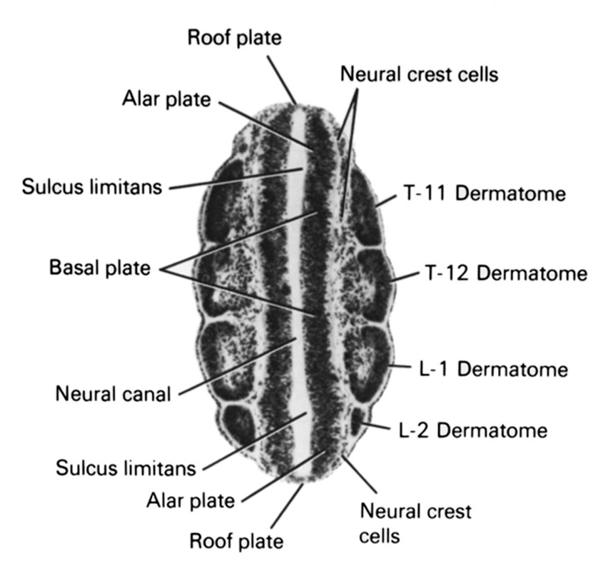 L-1 dermatome, L-2 dermatome, T-11 dermatome, T-12 dermatome, alar plate, basal plate, neural canal, neural crest cells, roof plate, sulcus limitans