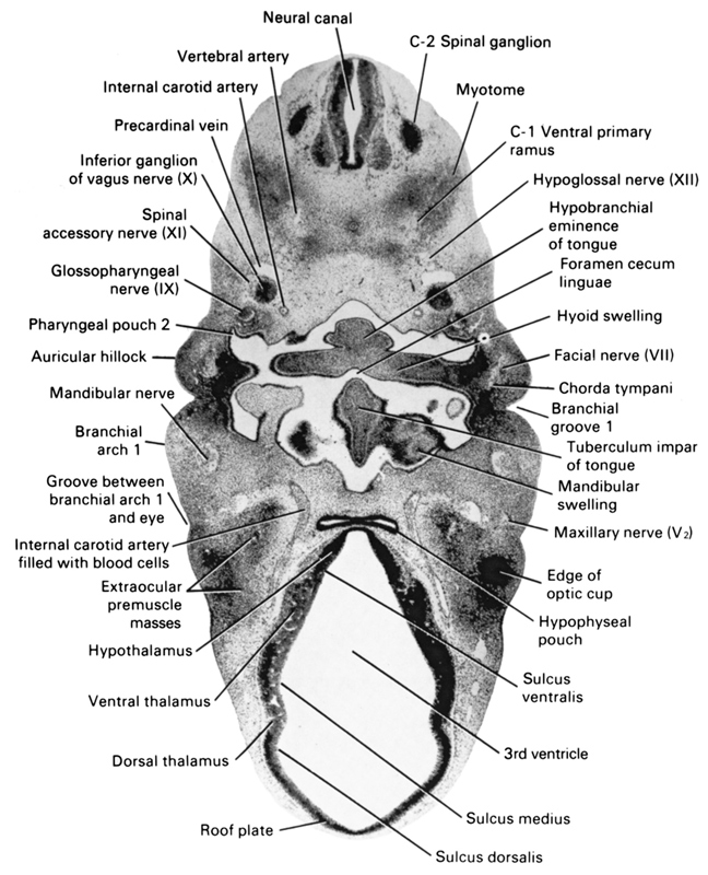 C-1 ventral primary ramus, C-2 spinal ganglion, auricular hillock, branchial arch 1, branchial groove 1, chorda tympani, dorsal thalamus, edge of optic cup, extra-ocular premuscle masses, facial nerve (CN VII), foramen cecum linguae, glossopharyngeal nerve (CN IX), groove between branchial arch 1 and eye, hyoid swelling, hypobranchial eminence of tongue, hypoglossal nerve (CN XII), hypophyseal  pouch, hypothalamus, inferior ganglion of vagus nerve (CN X), internal carotid artery, internal carotid artery filled with blood cells, mandibular nerve, mandibular swelling, maxillary nerve (CN V₂), myotome, neural canal, pharyngeal pouch 2, precardinal vein, roof plate, spinal accessory nerve (CN XI), sulcus dorsalis, sulcus medius, sulcus ventralis, third ventricle, tuberculum impar of tongue, ventral thalamus, vertebral artery