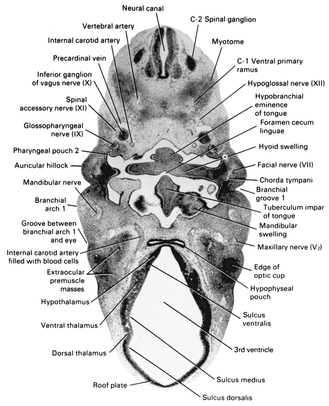 . Journal of comparative neurology . Fig. 11 Parasagittal section near  median surface of mandibular nerve, embryoof pig 17 mm. in length. E,  eustachian tube; Jug, jugular vein; Man, mandibu-lar nerve; Ot, otic  ganglion; *S, semilunar ganglion. Fig. 12